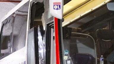 里昂在马赛的比赛因主教练在公共汽车袭击中受伤而中止